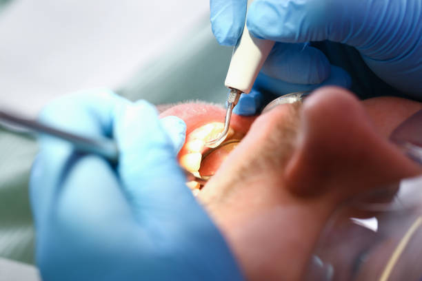Best Urgent Care for Lost Fillings or Crowns in Shady Hills, FL