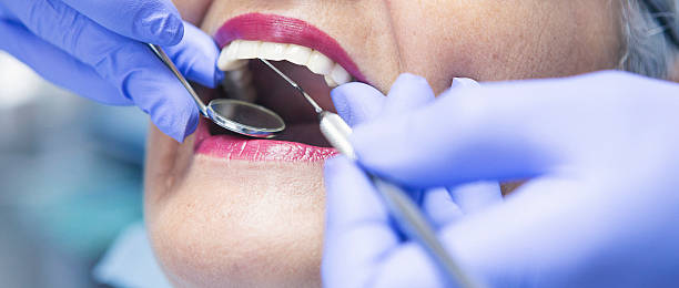 Best Emergency Tooth Extraction in Shady Hills, FL
